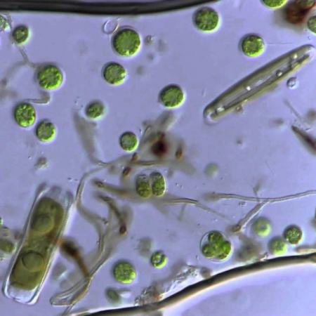 Bacteriën vijver
